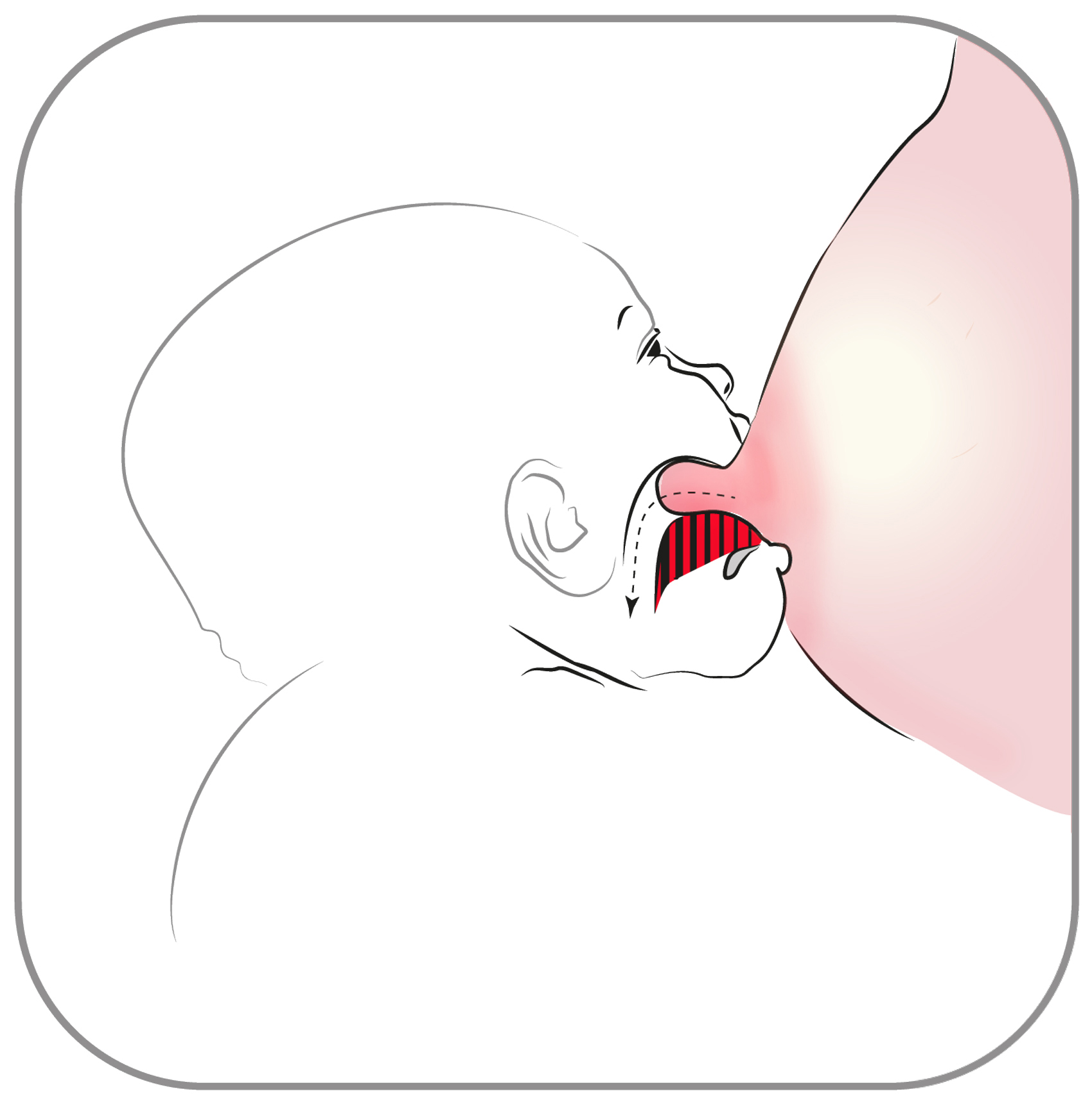 Barnets mun i genomskärning så man ser barnets tunga som pressar mot mammans bröstvårta inne i barnets mun.