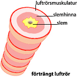 En illustrerad del av ett förträngt luftrör