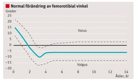 Normal förändring av femorotibial vinkel