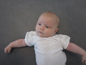 Bild spädbarn med vänstersidig CMT. 